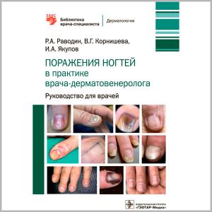 Фото - Поражения ногтей в практике врача-дерматовенеролога (мягкий переплет)