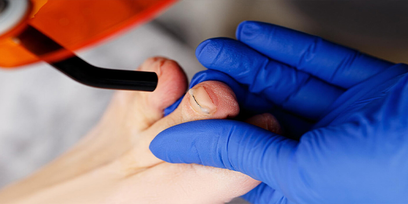 Установка Титановой нити