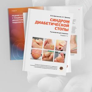 Фото - Синдром диабетической стопы: руководство для подолога