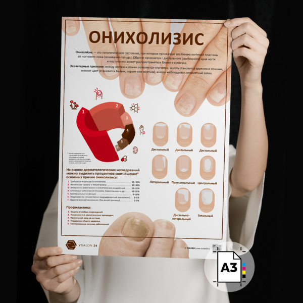 Фото - Онихолизис (плакат А3)