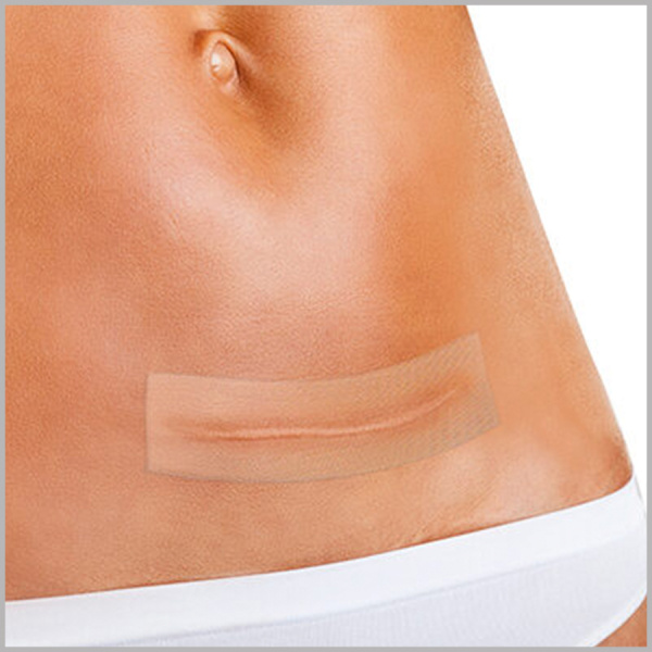 Фото - Силиконовый пластырь Fresco с мягким слоем от шрамов и рубцов 10х10 см