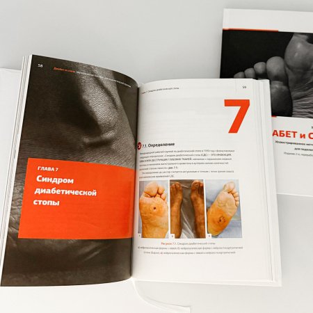 Фото - Диабет и стопа: иллюстрированное методическое пособие для подологической практики. 