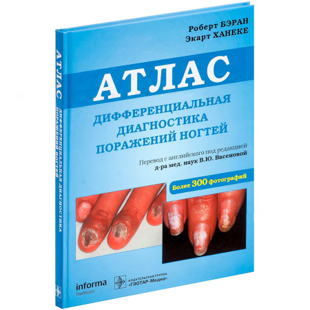 Фото - Дифференциальная диагностика поражений ногтей. Атлас
