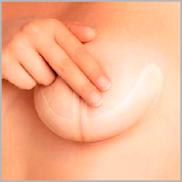 Фото - Силиконовый пластырь Fresco (якорь) от шрамов и рубцов (реабилитация после маммопластики) 