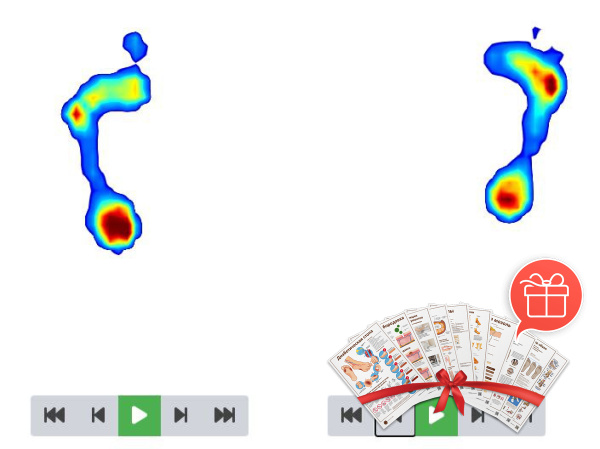 Фото - Podisense Go — бароподометрическая платформа