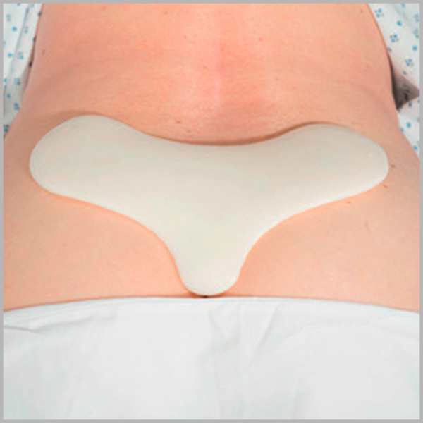 Фото - Подушка (прокладка) крестец для снятия давления и профилактики пролежней из полимерного геля Fresco