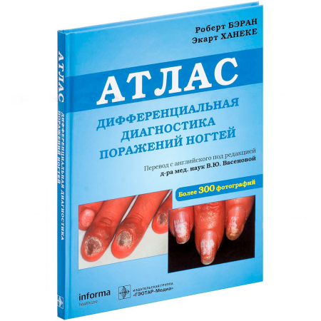 Фото - Дифференциальная диагностика поражений ногтей. Атлас