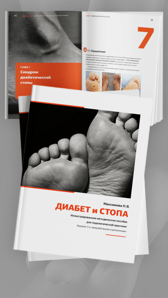 Фото - Диабет и стопа: иллюстрированное методическое пособие для подологической практики. 