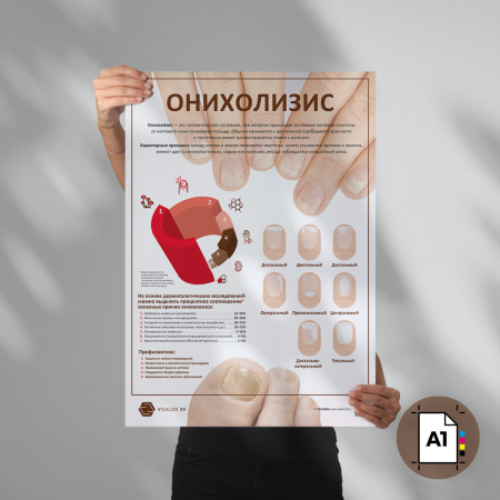 Фото - Онихолизис (плакат А1)