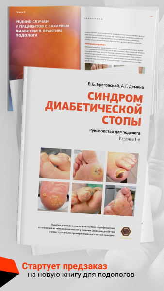Фото - Синдром диабетической стопы: руководство для подолога