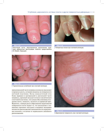 дифференциальная_диагностика_поражений_ногтей__атлас_10.jpg