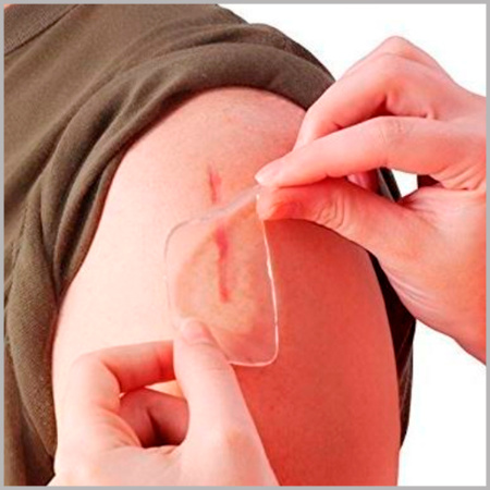 Фото - Силиконовый пластырь Fresco с мягким слоем от шрамов и рубцов 10х10 см