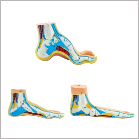 Фото - Анатомическая модель стопы в масштабе 1:1 (полая, плоская и нормальная стопа)