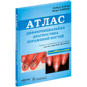 Фото - Дифференциальная диагностика поражений ногтей. Атлас