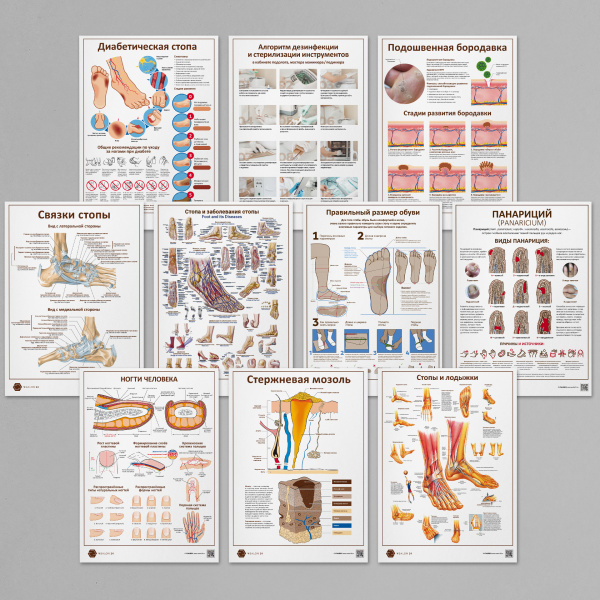 Фото - Набор плакатов 10 для подолога и ортопеда (формат А1)