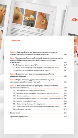 Фото - Синдром диабетической стопы: руководство для подолога