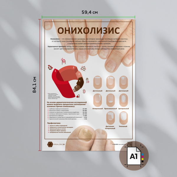 Фото - Онихолизис (плакат А1)