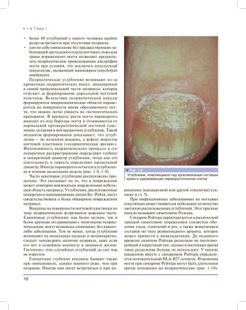 Фото - Дифференциальная диагностика поражений ногтей. Атлас