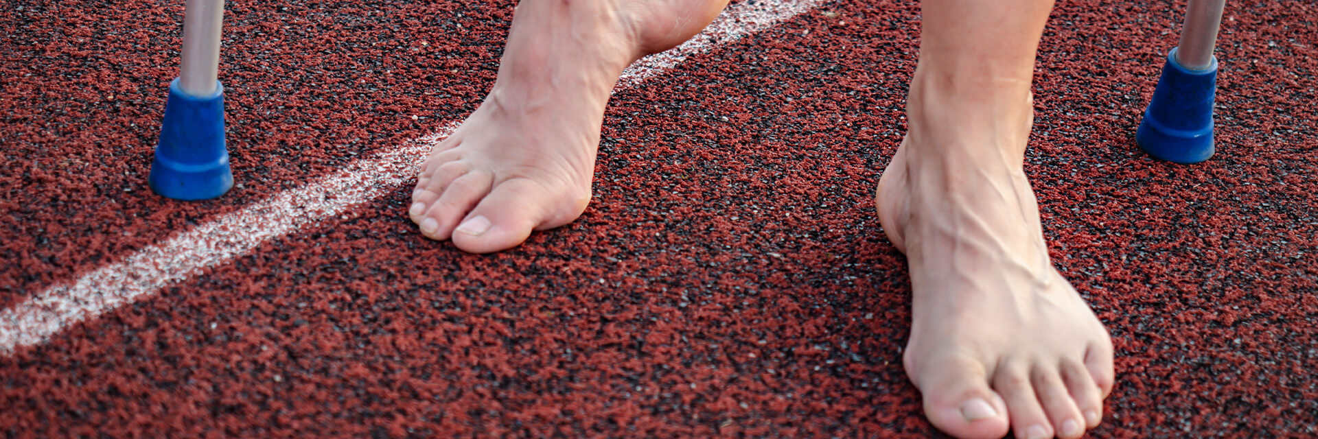 Атлетическая стопа (стопа атлета) Атлетическая стопа (стопа атлета)